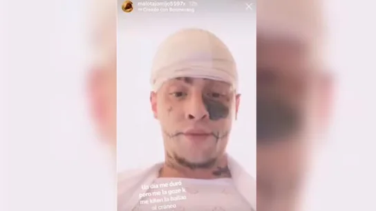 Imagen del joven que alardea de haber estampado su coche Imagen del joven que alardea de haber estampado su coche