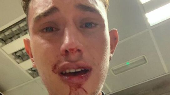 Jordi Rofes, joven agredido en el metro de Barcelona