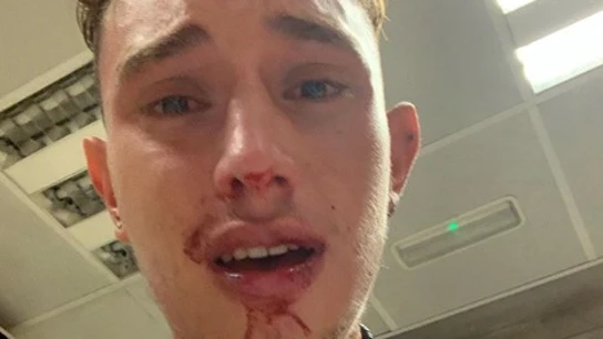 Jordi Rofes, joven agredido en el metro de Barcelona Jordi Rofes, joven agredido en el metro de Barcelona