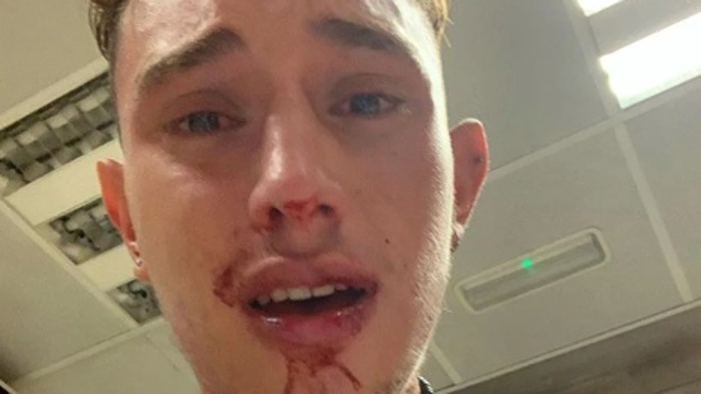 Jordi Rofes, joven agredido en el metro de Barcelona Jordi Rofes, joven agredido en el metro de Barcelona