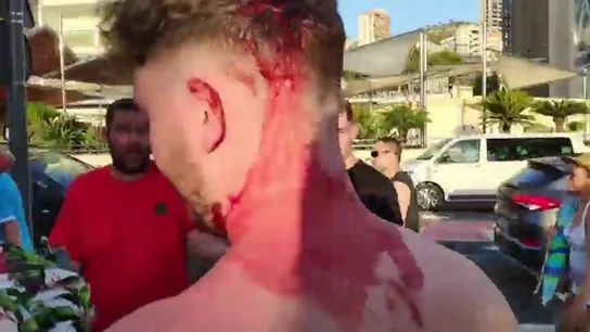 La herida provocada por la agresión de los trileros La herida provocada por la agresión de los trileros