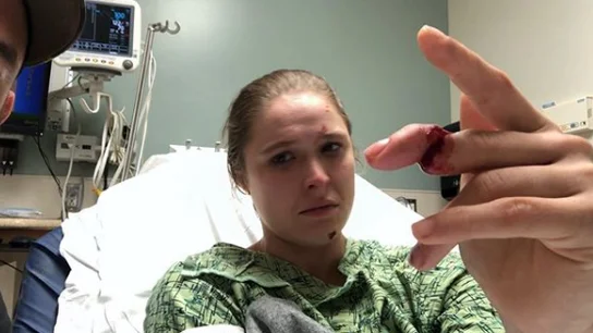 Ronda Rousey, cerca de perder un dedo Ronda Rousey, cerca de perder un dedo