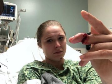 Ronda Rousey, cerca de perder un dedo Ronda Rousey, cerca de perder un dedo
