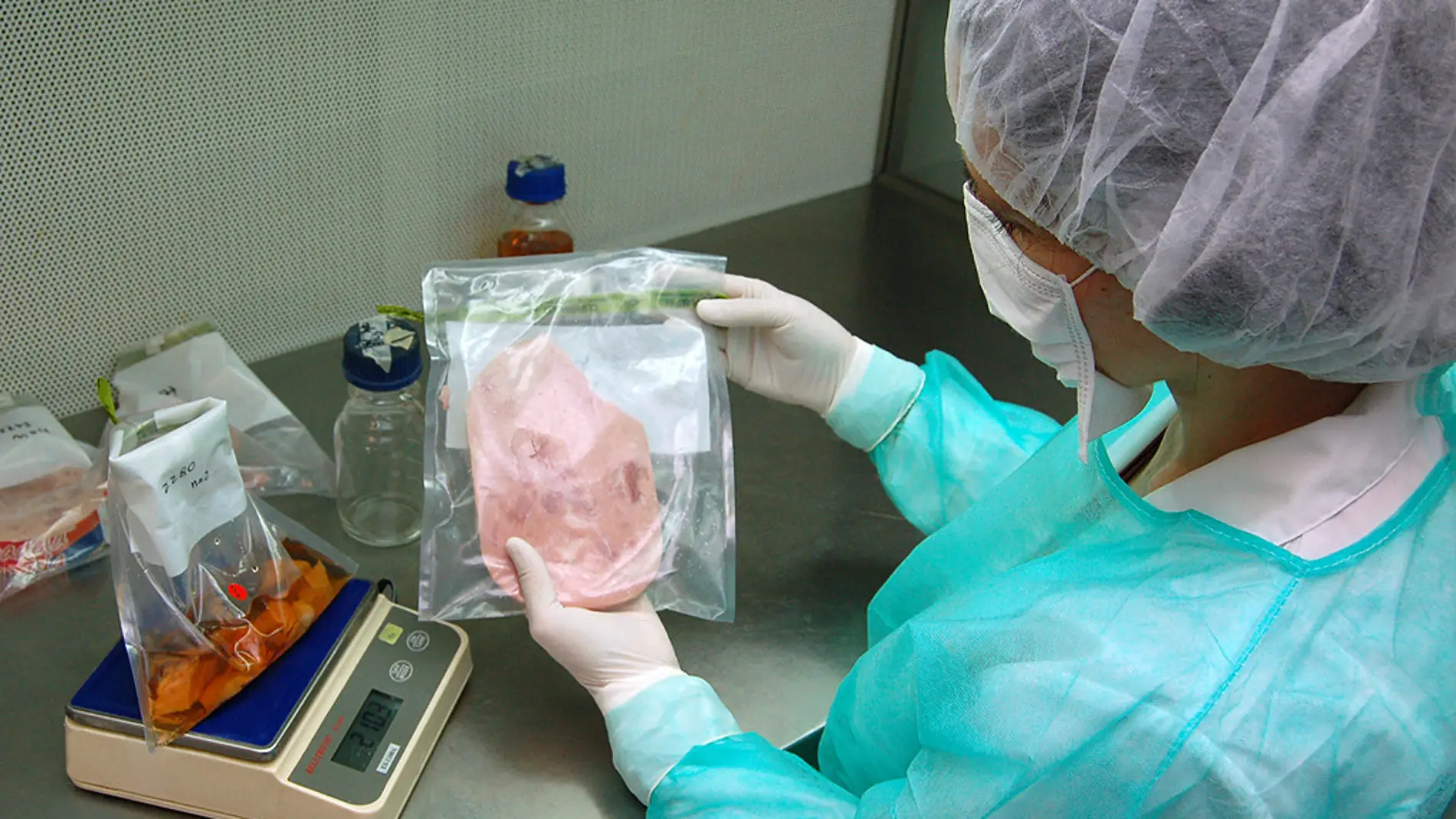 Espana activa la alerta internacional sobre el brote de listeriosis