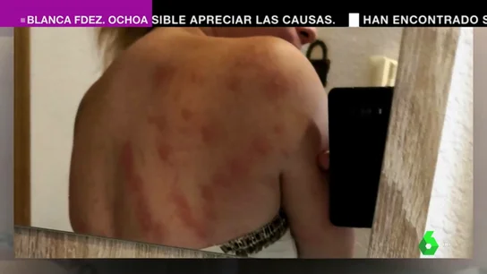 Los vecinos de Elche denuncian una agresiva plaga de insectos Los vecinos de Elche denuncian una agresiva plaga de insectos