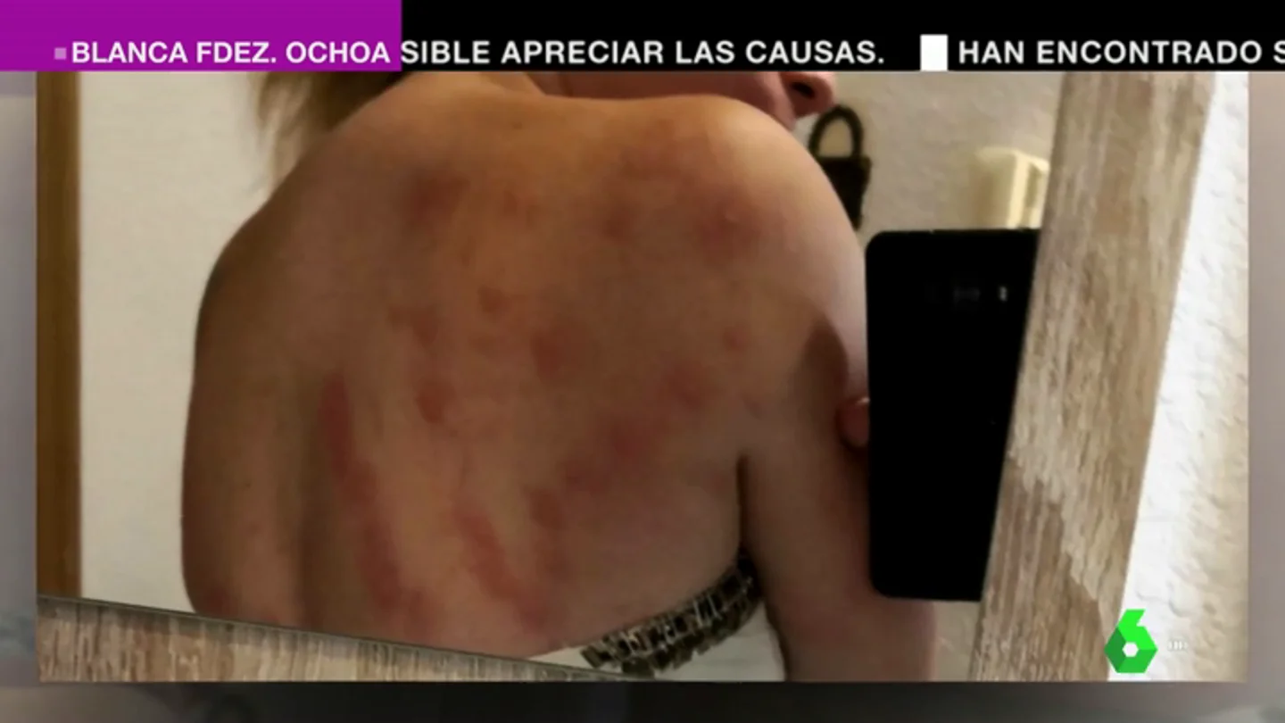 Los vecinos de Elche denuncian una agresiva plaga de insectos Los vecinos de Elche denuncian una agresiva plaga de insectos