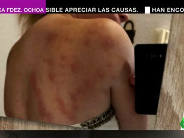 Los vecinos de Elche denuncian una agresiva plaga de insectos Los vecinos de Elche denuncian una agresiva plaga de insectos