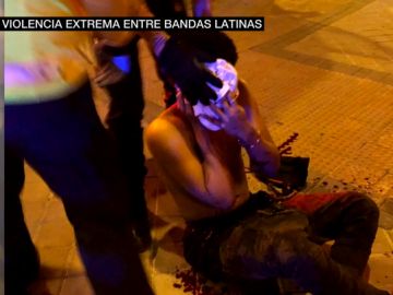 Uno de los heridos en la reyerta entre bandas en el distrito madrileño de Vallecas Uno de los heridos en la reyerta entre bandas en el distrito madrileño de Vallecas