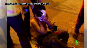 Uno de los heridos en la reyerta entre bandas en el distrito madrileño de Vallecas