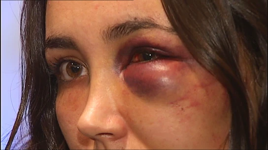 Superviviente de violencia machista. Basauri. Violencia machista.