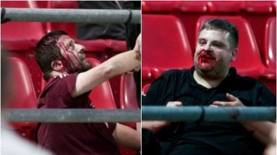 Hinchas del Bayern, heridos gravemente en la grada Hinchas del Bayern, heridos gravemente en la grada