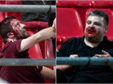 Hinchas del Bayern, heridos gravemente en la grada Hinchas del Bayern, heridos gravemente en la grada