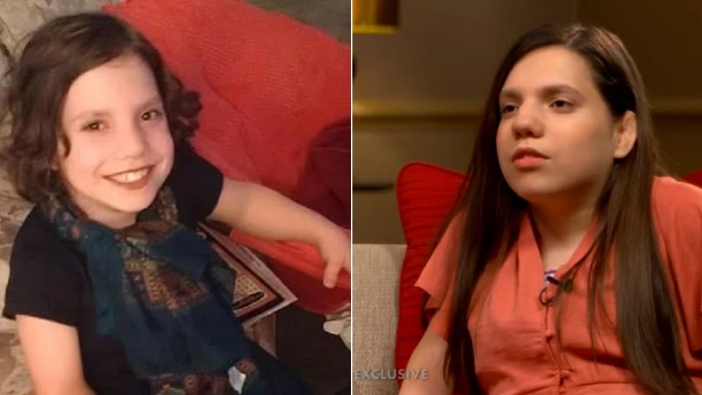 Natalia Grace cuando era una niña y ahora