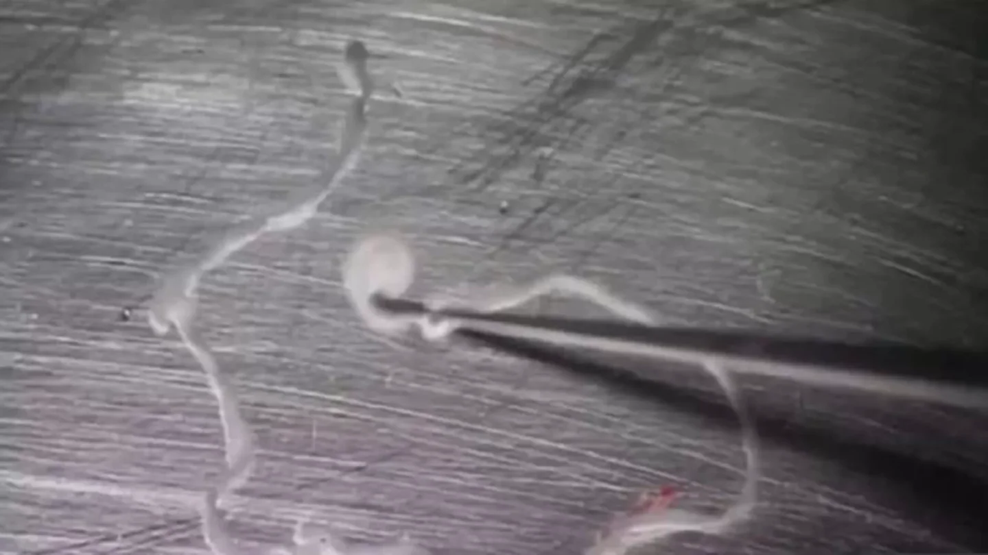 Imagen de la tenia de 12 centímetros que llevaba 15 años comiéndose el cerebro de un hombre Imagen de la tenia de 12 centímetros que llevaba 15 años comiéndose el cerebro de un hombre