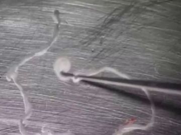 Imagen de la tenia de 12 centímetros que llevaba 15 años comiéndose el cerebro de un hombre Imagen de la tenia de 12 centímetros que llevaba 15 años comiéndose el cerebro de un hombre
