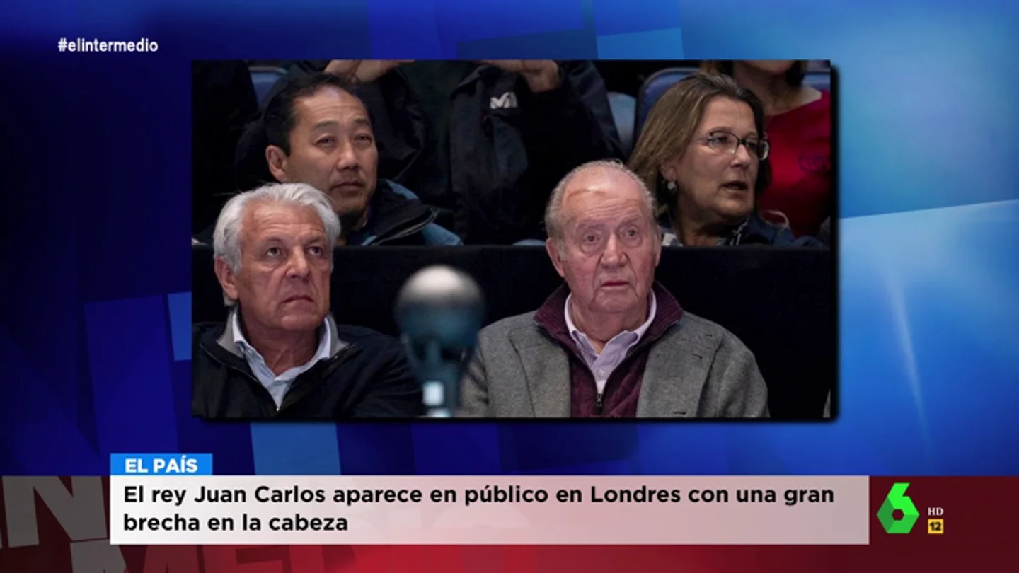 Así fue el accidente doméstico del rey Juan Carlos que le dejó con una gran brecha en la cabeza Así fue el accidente doméstico del rey Juan Carlos que le dejó con una gran brecha en la cabeza