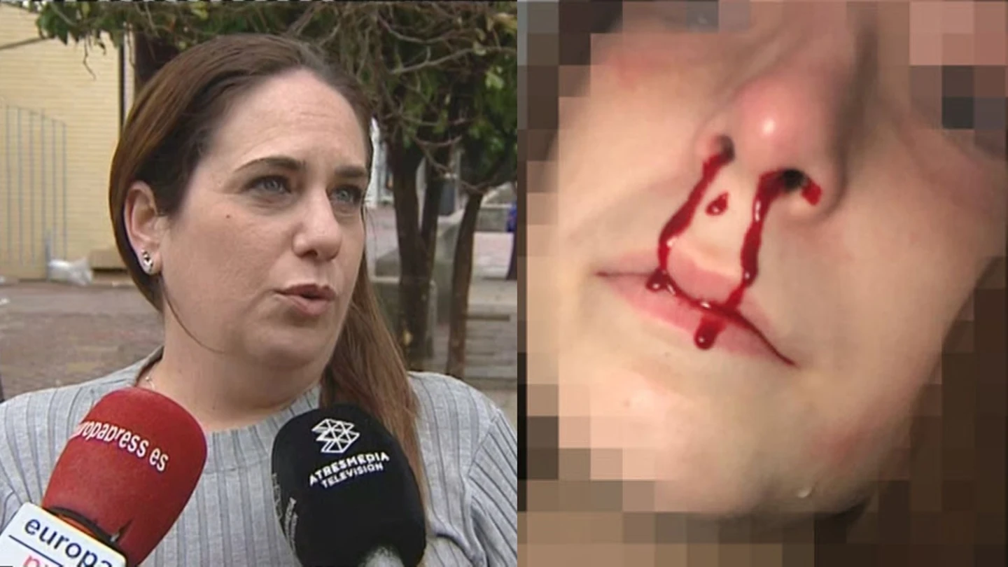 Eva Tejero, la madre de la niña agredida en Jerez Eva Tejero, la madre de la niña agredida en Jerez