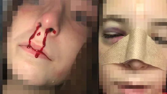 La menor agredida en un instituto de Jerez La menor agredida en un instituto de Jerez