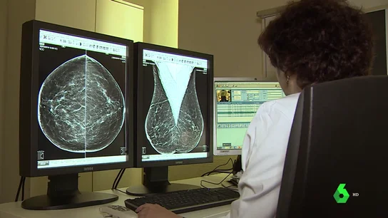 Así luchan en el CNIO contra el cáncer de mama: ocho de cada diez personas logran curarse gracias a los avances Así luchan en el CNIO contra el cáncer de mama: ocho de cada diez personas logran curarse gracias a los avances