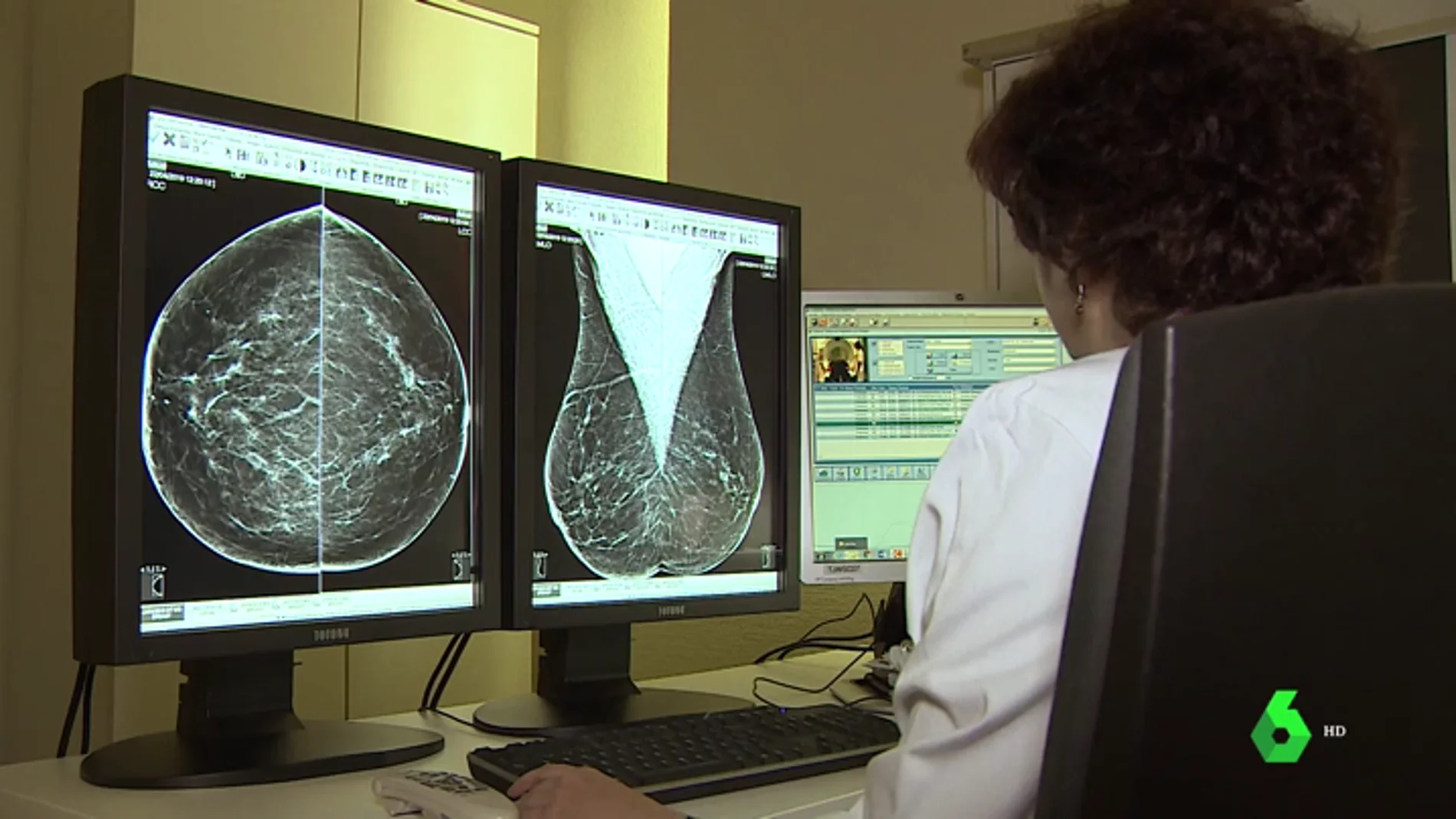 Así luchan en el CNIO contra el cáncer de mama: ocho de cada diez personas logran curarse gracias a los avances