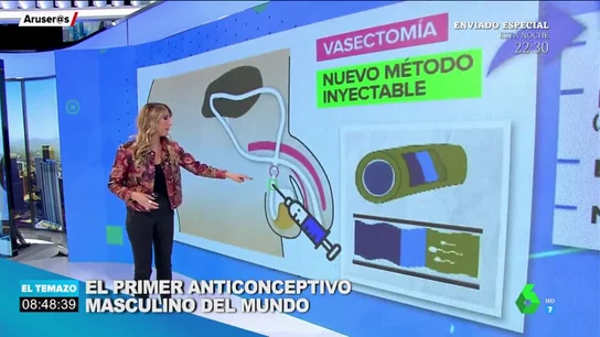 vasectomia vasectomia