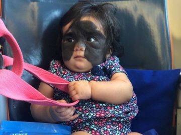 La pequeña Luna Fenner, cuando aún no había sido operada La pequeña Luna Fenner, cuando aún no había sido operada