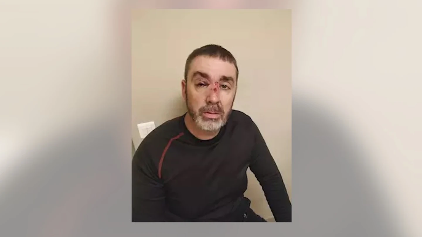 Uno de los vigilantes de seguridad agredidos durante la pelea en la Renfe. Uno de los vigilantes de seguridad agredidos durante la pelea en la Renfe.