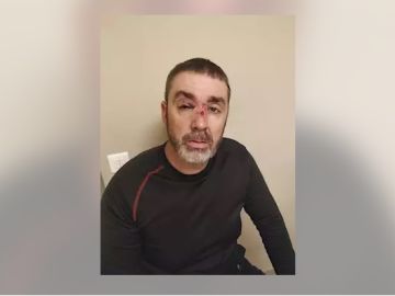 Uno de los vigilantes de seguridad agredidos durante la pelea en la Renfe. Uno de los vigilantes de seguridad agredidos durante la pelea en la Renfe.