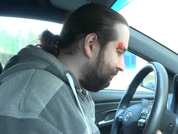 CALCULAR LA INDEMNIZACIÓN CALCULAR LA INDEMNIZACIÓN