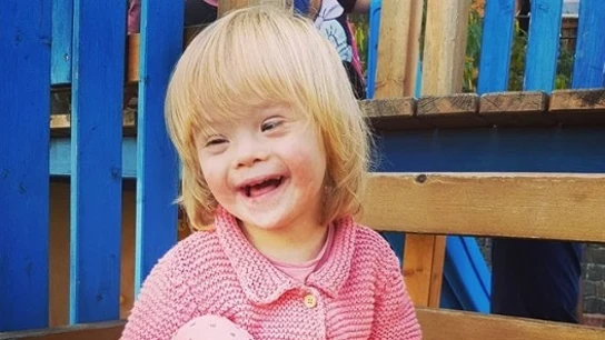 Alba, una pequeña con Síndrome de Down Alba, una pequeña con Síndrome de Down