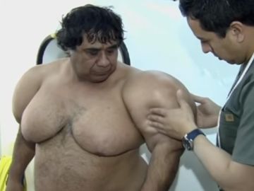 El buzo Alejandro Ramos, tratándose sus deformidades El buzo Alejandro Ramos, tratándose sus deformidades