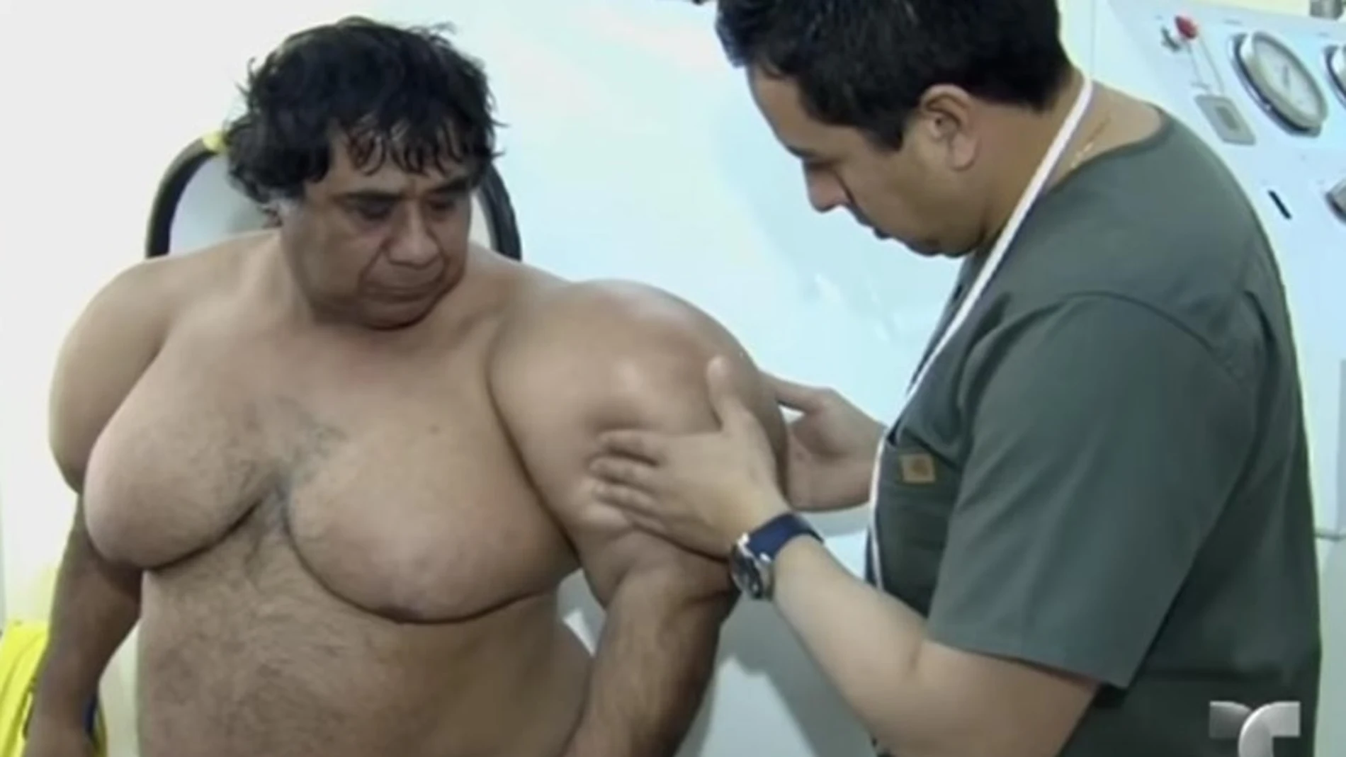 El buzo Alejandro Ramos, tratándose sus deformidades