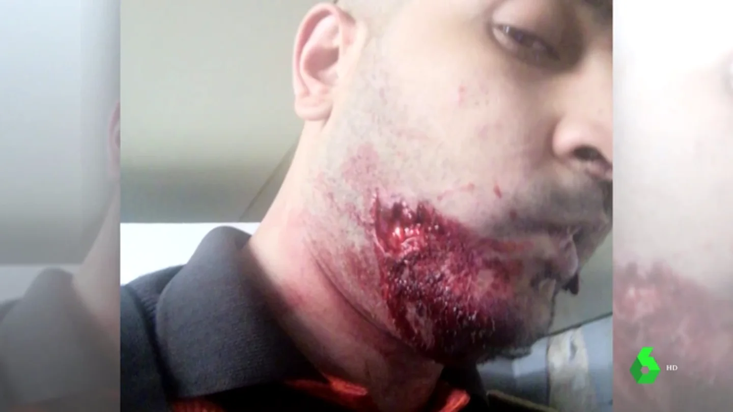 Muerden brutalmente a un vigilante del Metro de Barcelona Muerden brutalmente a un vigilante del Metro de Barcelona