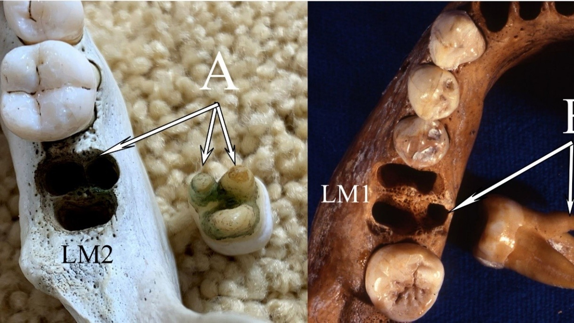 Los dientes de denisovanos y asiaticos actuales no son iguales
