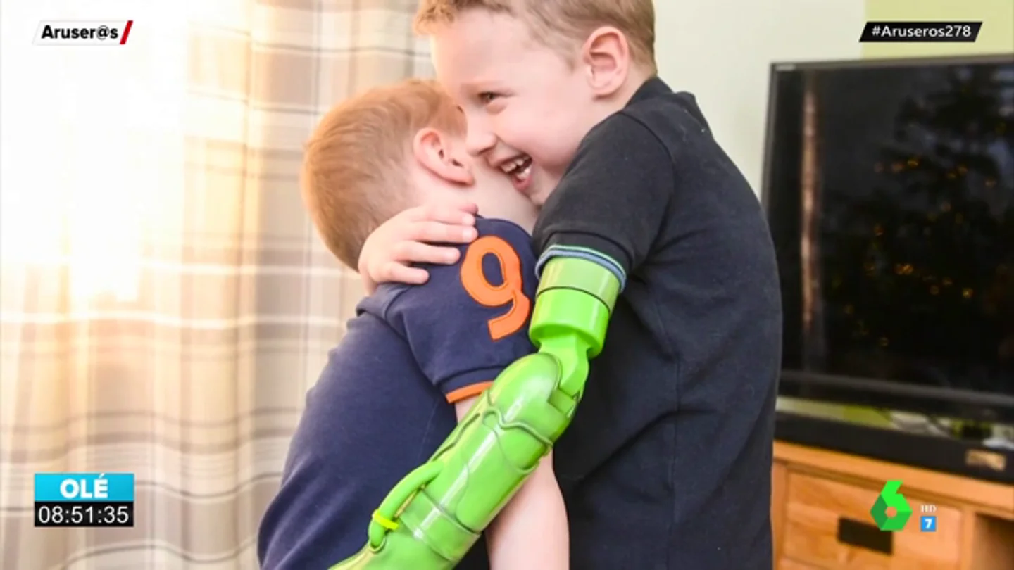 El primer abrazo de un niño de cinco años a su hermano tras ponerle una prótesis en el brazo El primer abrazo de un niño de cinco años a su hermano tras ponerle una prótesis en el brazo