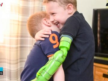 El primer abrazo de un niño de cinco años a su hermano tras ponerle una prótesis en el brazo El primer abrazo de un niño de cinco años a su hermano tras ponerle una prótesis en el brazo