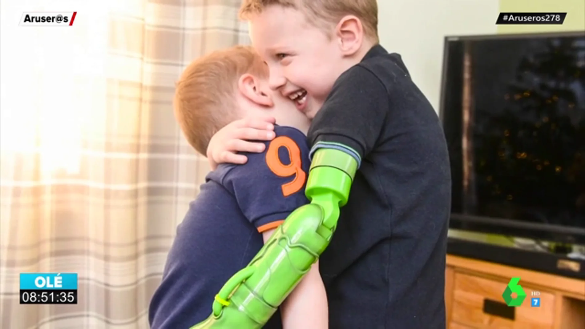 El primer abrazo de un niño de cinco años a su hermano tras ponerle una prótesis en el brazo
