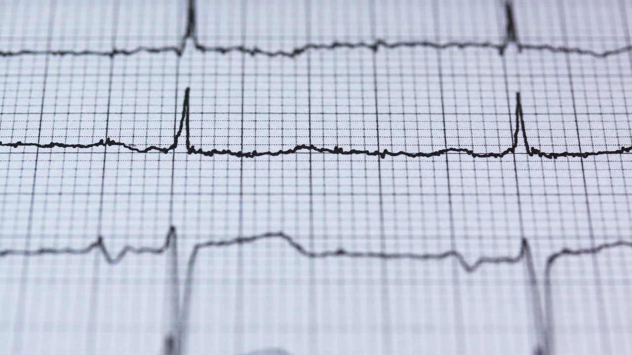 Une polypilule espagnole parvient à réduire de 33% la mortalité cardiovasculaire après une crise cardiaque