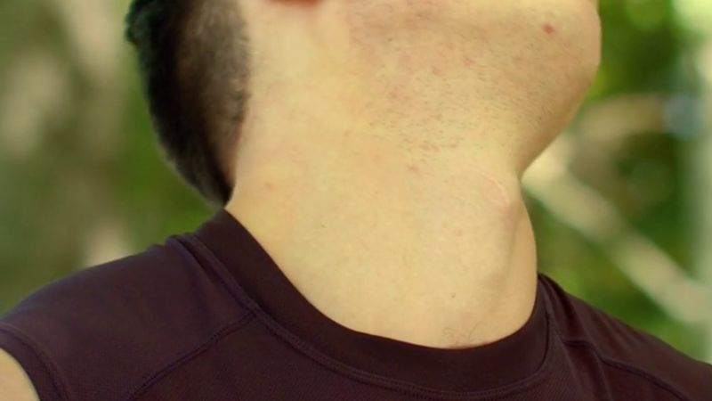 ¿Por qué las mujeres no tienen nuez?
