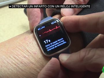 Detectar un infarto con un reloj inteligente Detectar un infarto con un reloj inteligente