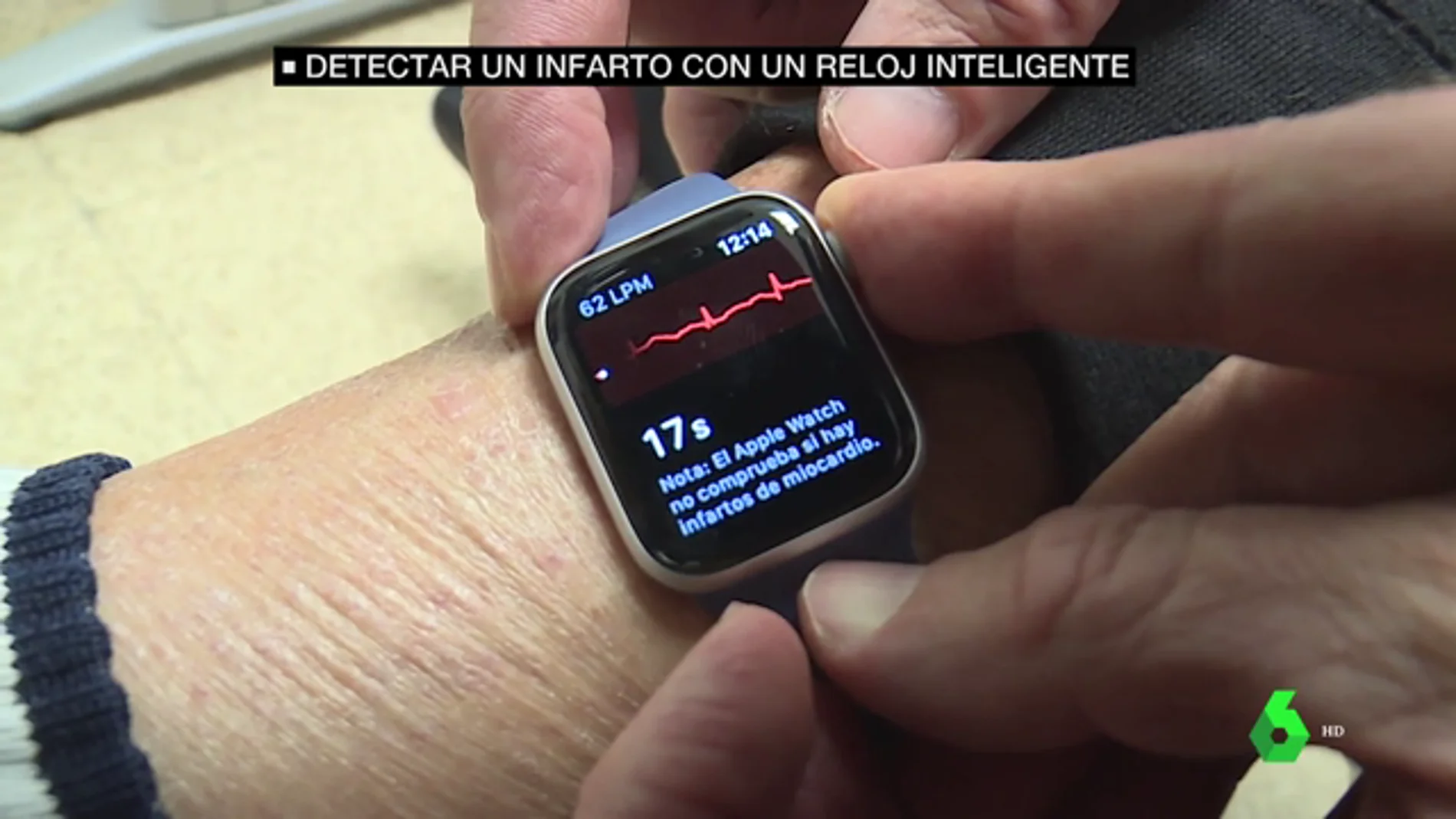 Bajar Mucho bien bueno medida Detectar un infarto con un reloj inteligente es posible e igual de fiable  que con pruebas médicas
