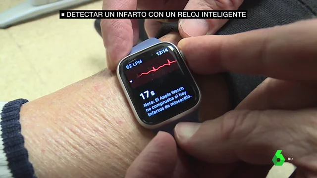 Detectar un infarto con un reloj inteligente