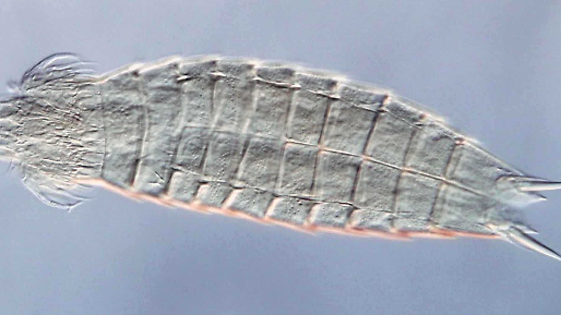 La especie Echinoderes brevipes, tomada con microscopía óptica diferencial de contraste de interferencia. / Diego Cepeda