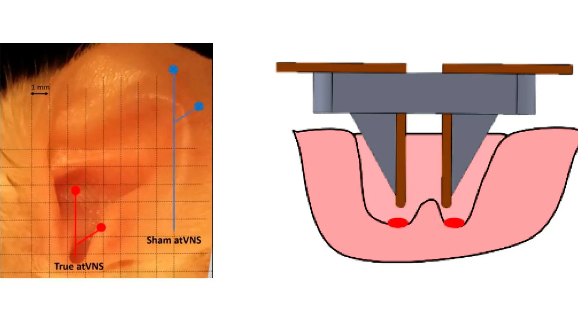 esquema del dispositivo de electroestimulación