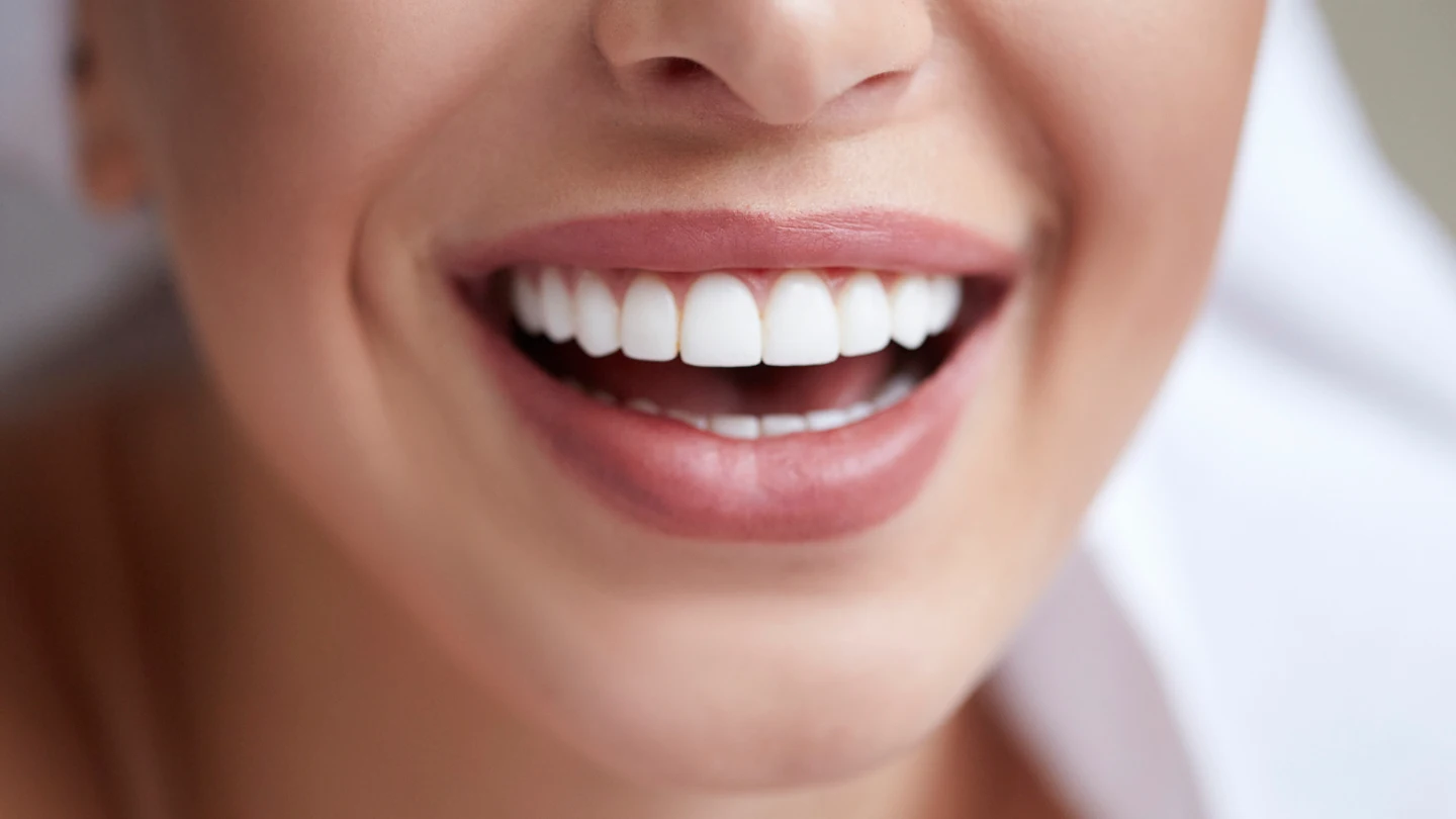 Sonrisa Sonrisa