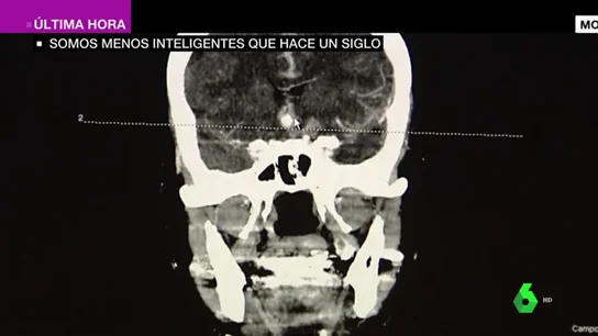 La tecnología nos atrofia: los humanos somos menos inteligentes que hace un siglo La tecnología nos atrofia: los humanos somos menos inteligentes que hace un siglo
