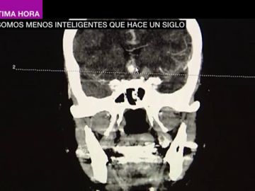 La tecnología nos atrofia: los humanos somos menos inteligentes que hace un siglo La tecnología nos atrofia: los humanos somos menos inteligentes que hace un siglo