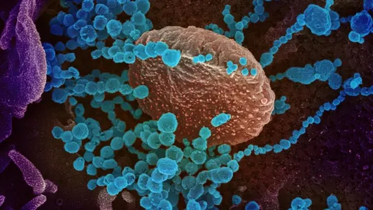 Imagen de microscopio del SARS-CoV-2 Imagen de microscopio del SARS-CoV-2