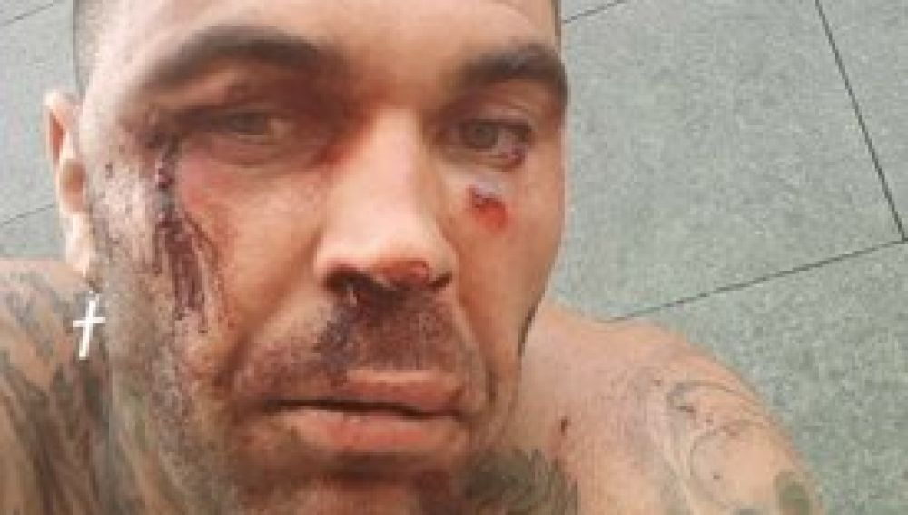 El ultra del Betis que agredió a un ciudadano bilbaíno sufre una paliza durante el carnaval de Tenerife