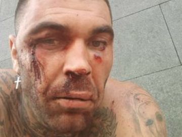 El ultra del Betis que agredió a un ciudadano bilbaíno sufre una paliza durante el carnaval de Tenerife El ultra del Betis que agredió a un ciudadano bilbaíno sufre una paliza durante el carnaval de Tenerife